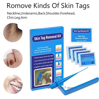 Bőr Címke Eltávolító Készlet Távolítsa el a Szemölcsök test bőrápoló eszközök szemölcs kezelésére Tisztít Törlőkendő szemölcs, Anyajegy-Eltávolító Skin Tag remoal Micro Zenekar